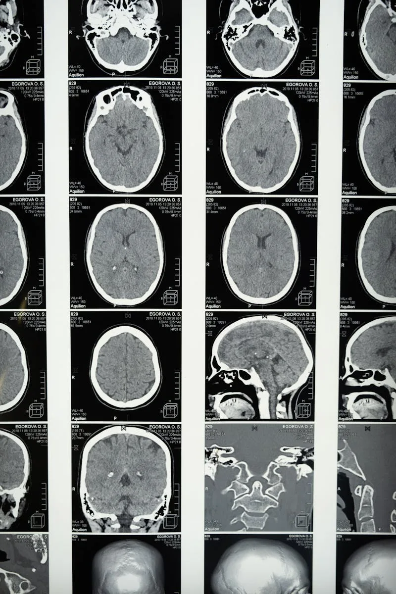 The Gut-Brain Axis: How Your Digestive System Affects Mental Health